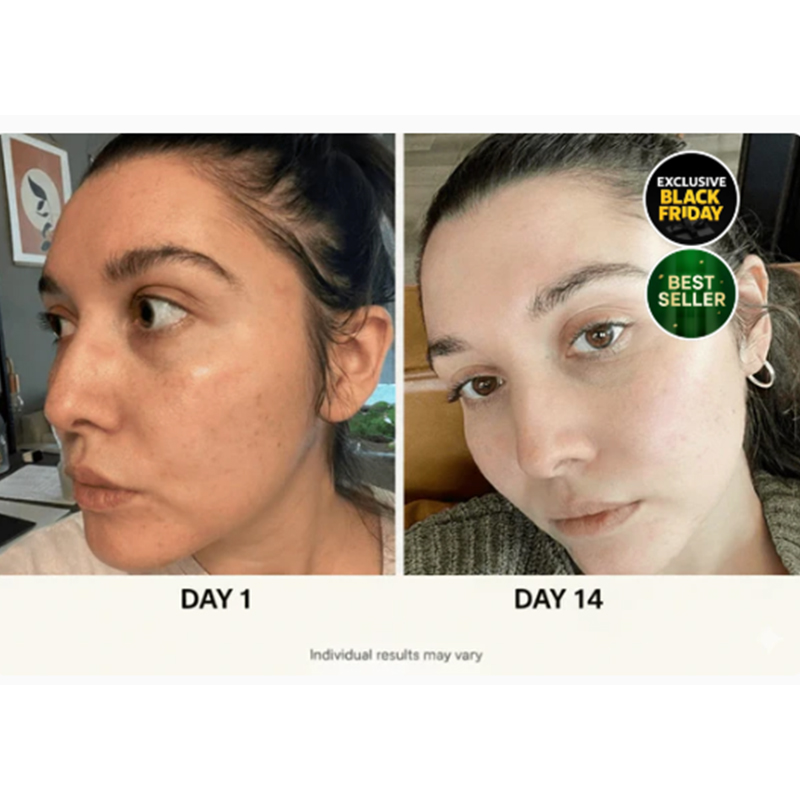 6-stufiges koreanisches Hautpflegeset - Image 4