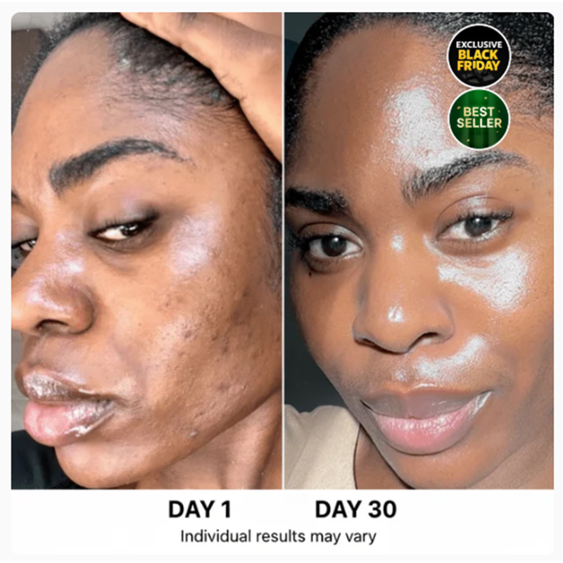 4-stufiges koreanisches Hautpflegeset - Image 2