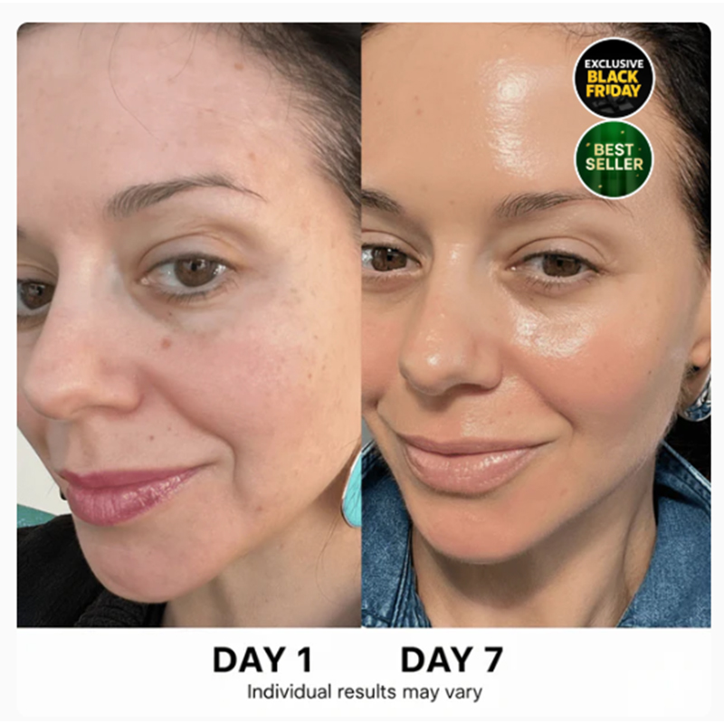 4-stufiges koreanisches Hautpflegeset - Image 3