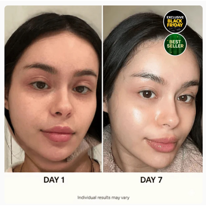 4-stufiges koreanisches Hautpflegeset - Image 4