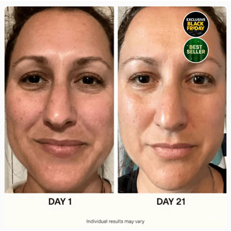 6-stufiges koreanisches Hautpflegeset - Image 2