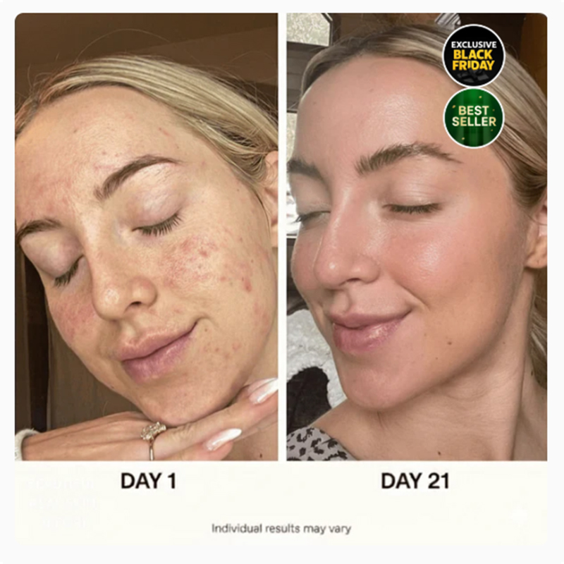 6-stufiges koreanisches Hautpflegeset - Image 3